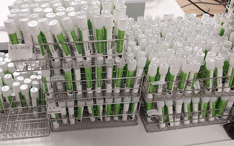 Miles de muestras pendientes en los laboratorios del Hospital de Jerez por la falta de personal